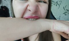 Angelica's hard bites!!