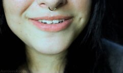 Inside Aamiees Mouth after the Dentist visit