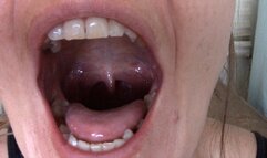 Sarah's Uvula Dangle