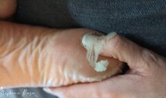 Extreme Dry Feet Peeling