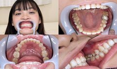 Urara - Watching Inside mouth of Japanese cute girl bite-264-1 - 1080p