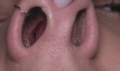 big nostrils and piggy nose