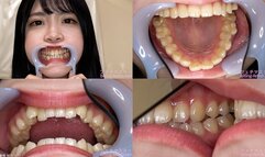 Akari - Watching Inside mouth of Japanese cute girl bite-265-1 - MOV 1080p