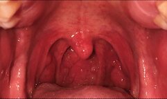 GIANT CLARK - MOUTH & THROAT EXPLORATION