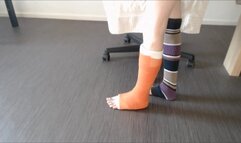 I Am Showing You My Leg In A Cast From All Sides