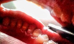 Yawning - Reverse View CUSTOM