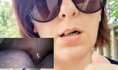 MiroCam new Vore exploration with medical PillCam in outdoor 4K