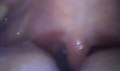 New outdoor PillCam exploration - FullScreen edition empty stomach sounds with water 720HD