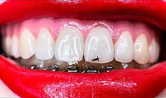 Punishing My Tiny Servant CUSTOM