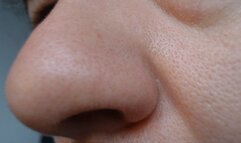 My nose very close