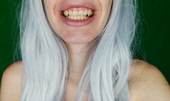 My teeth are chattering (NO AUDIO)