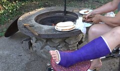 Wife in cast on holiday