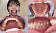 Suzu - Watching Inside mouth of Japanese cute girl bite-269-1 - 1080p