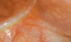 Endoscopic journey into my wet pussy in very high resolution with asmr trigger sounds 720HD