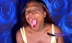 Super Wide Loud Yawns, you can see down my throat