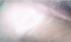 Microscopic camera checking my vagina