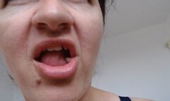 Decapitated jelly bear has no fear :)