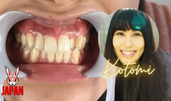 Dental Sensation: Brushing, Sensitivity, and Intrigue