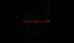 Bunions in red sandals