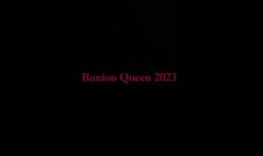 Bunions in sexy sandals