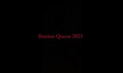 Bunions in sexy shoes