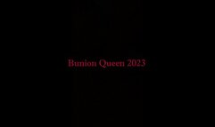 Bunions in tan nylons