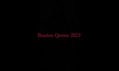 Bunions in pink sandals