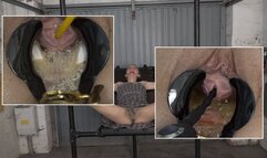 Catheter, bubble pussy and dilator ( 720p wmv )