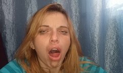 severe tuberculous cough (open cough)