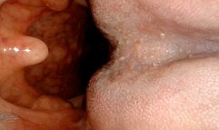 Endoscope view from the palate