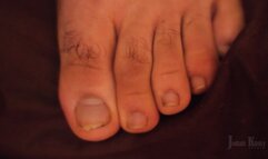 Cutting Dirty Toenails