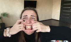 Crazy hands want to destroy the face