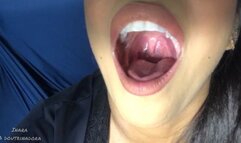 my mouth open huge, uvula bouncing. White teeth
