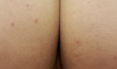 Farting clips compilation