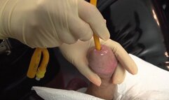 Another Foley Catheter Insertion (White Latex Gloves)