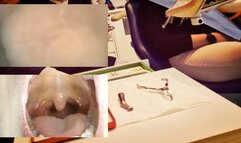 New Experiment - Dental Vore 4K