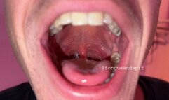 Logan Mouth Part11 Video1 - MP4