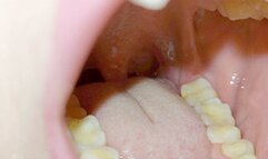 teeth tour -admire my teeth very close to the camera ---