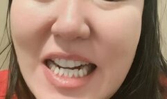 Gum irritation after brushing