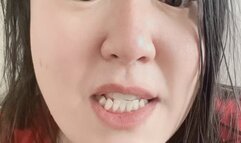 Talking about dental care