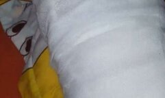 Wiggling my toes in cast