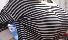 Carina breast expansion