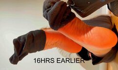 Vinegary Soles Afterwork #Aromatherapy Dry Heels Nutload Yanking - Lotus