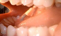 game inside my mouth