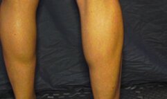 Dance The Muscles 99