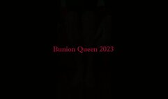 Bunions in front of camera