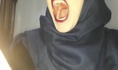 Show my mouth and teeth 2