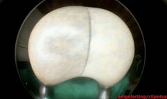 Farts arrangement with neighbor wmv