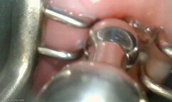 cervix pried open and penetrated