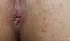 Farting extreme close-up 5